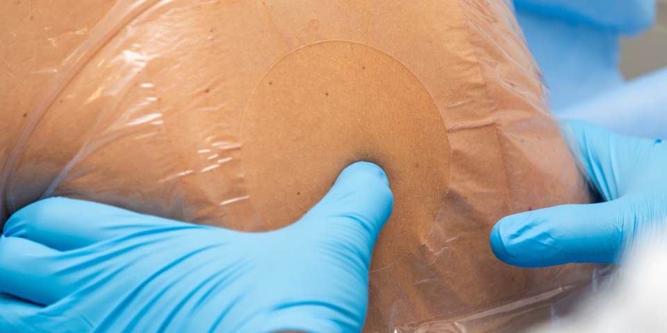 Læge laver lumbalpunktur