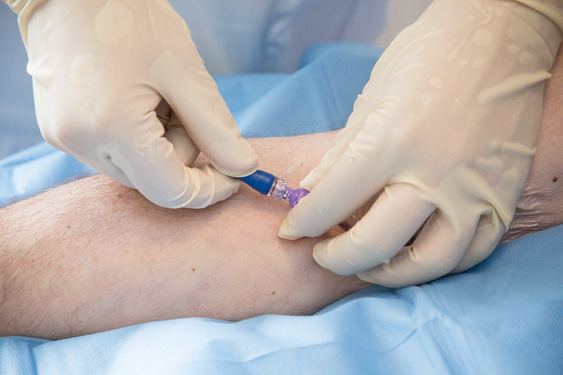 Indsættelse af kateter