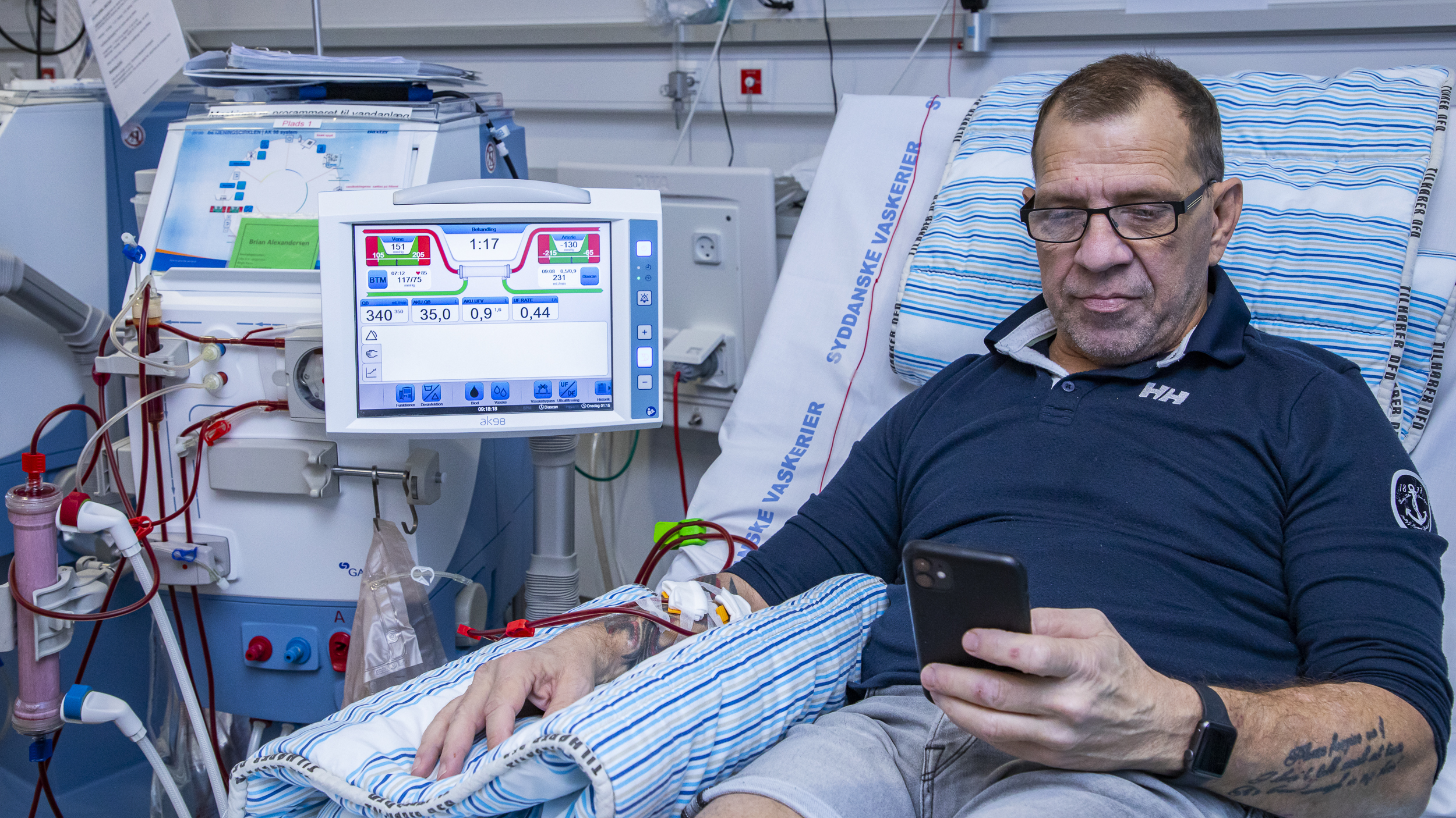 Patient ligger i seng og får dialyseret blodet