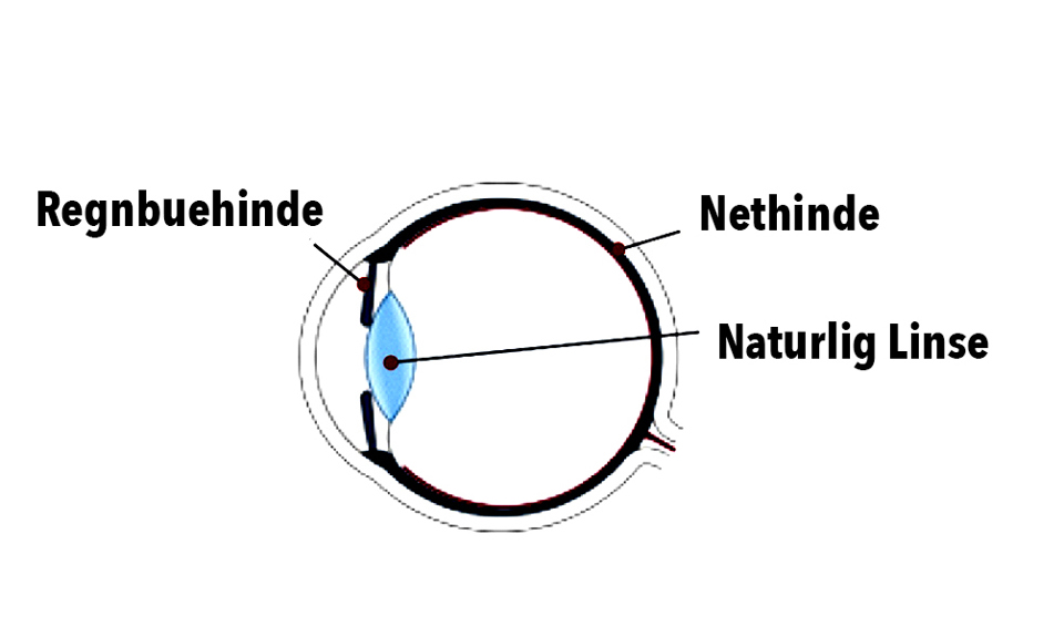 Tegning af et øje set fra siden. Regnbuehinden er foran den naturlige linse. Nethinden er bagerst.